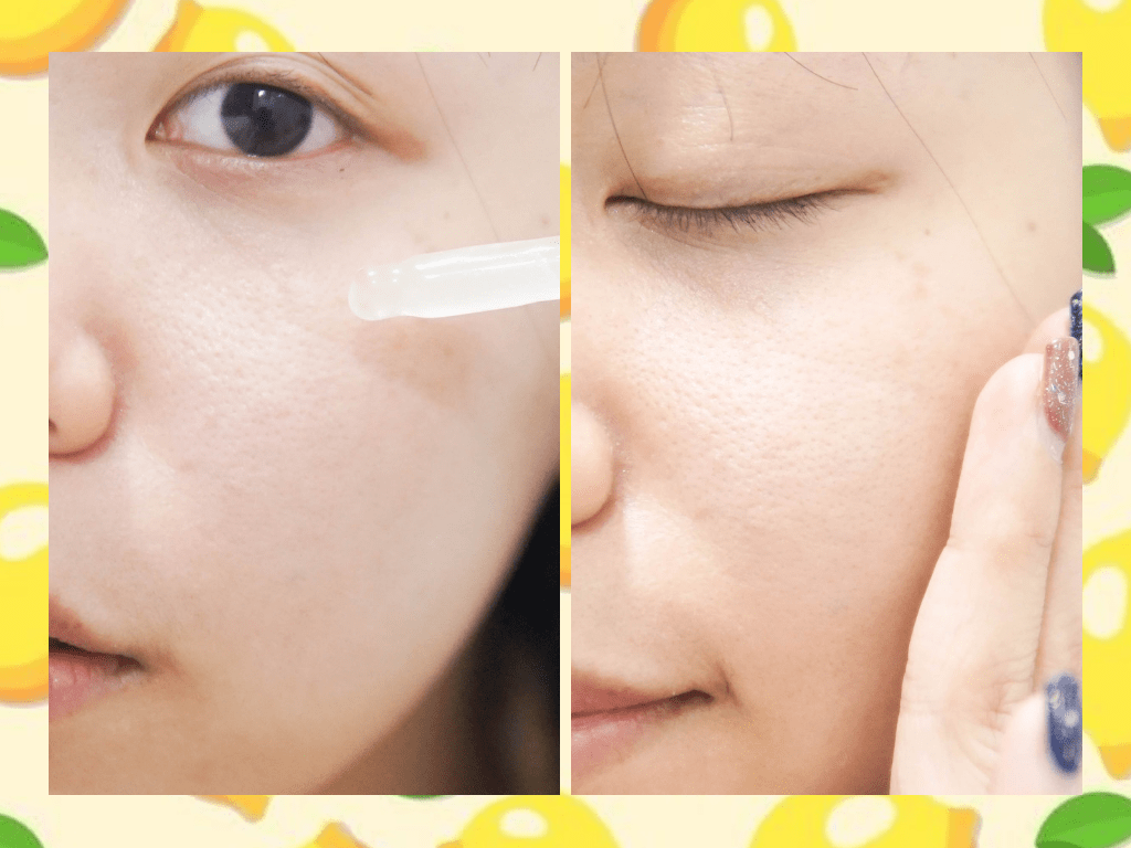 บอกลาจุดด่างดำ ช่วยให้ผิวขาวแบบเร่งด่วนด้วย MERCI Vitamin C Extra Bright Serum